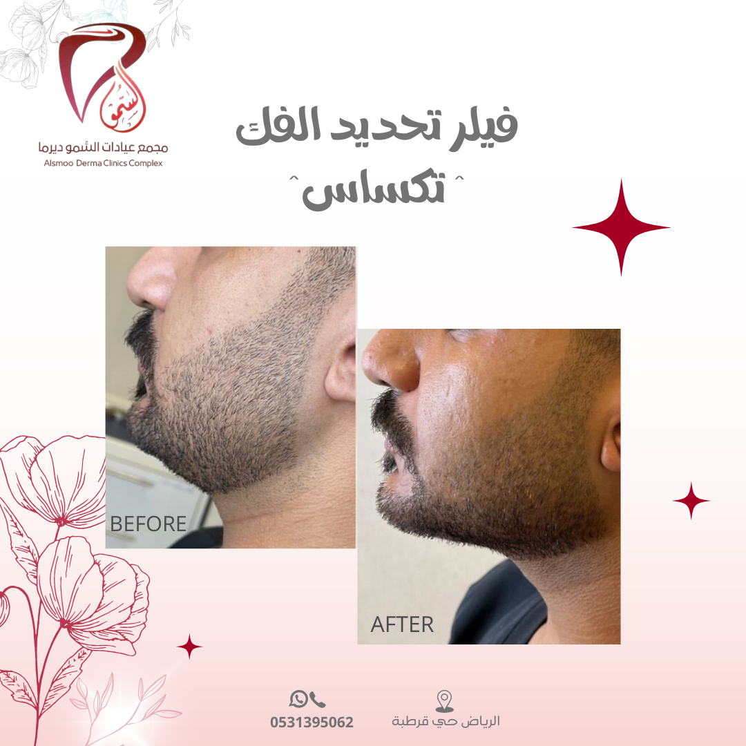 0533 22 4799 (3000 x 1000 بيكسل) (1080 x 1080 بيكسل) (12)