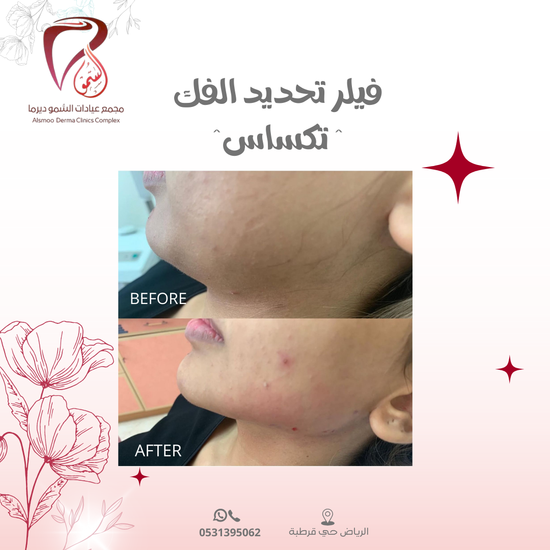 0533 22 4799 (3000 x 1000 بيكسل) (1080 x 1080 بيكسل) (13)