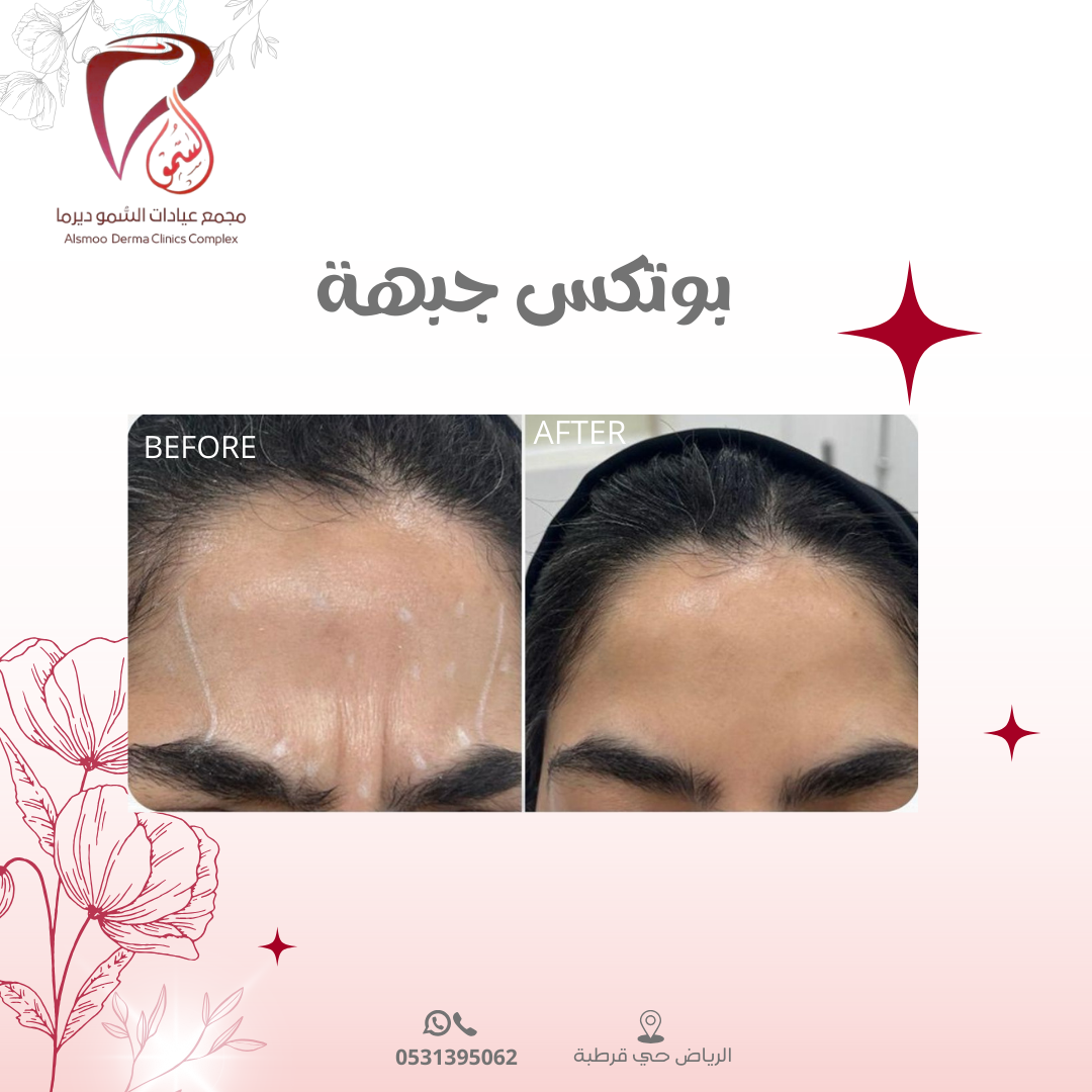 0533 22 4799 (3000 x 1000 بيكسل) (1080 x 1080 بيكسل) (14)