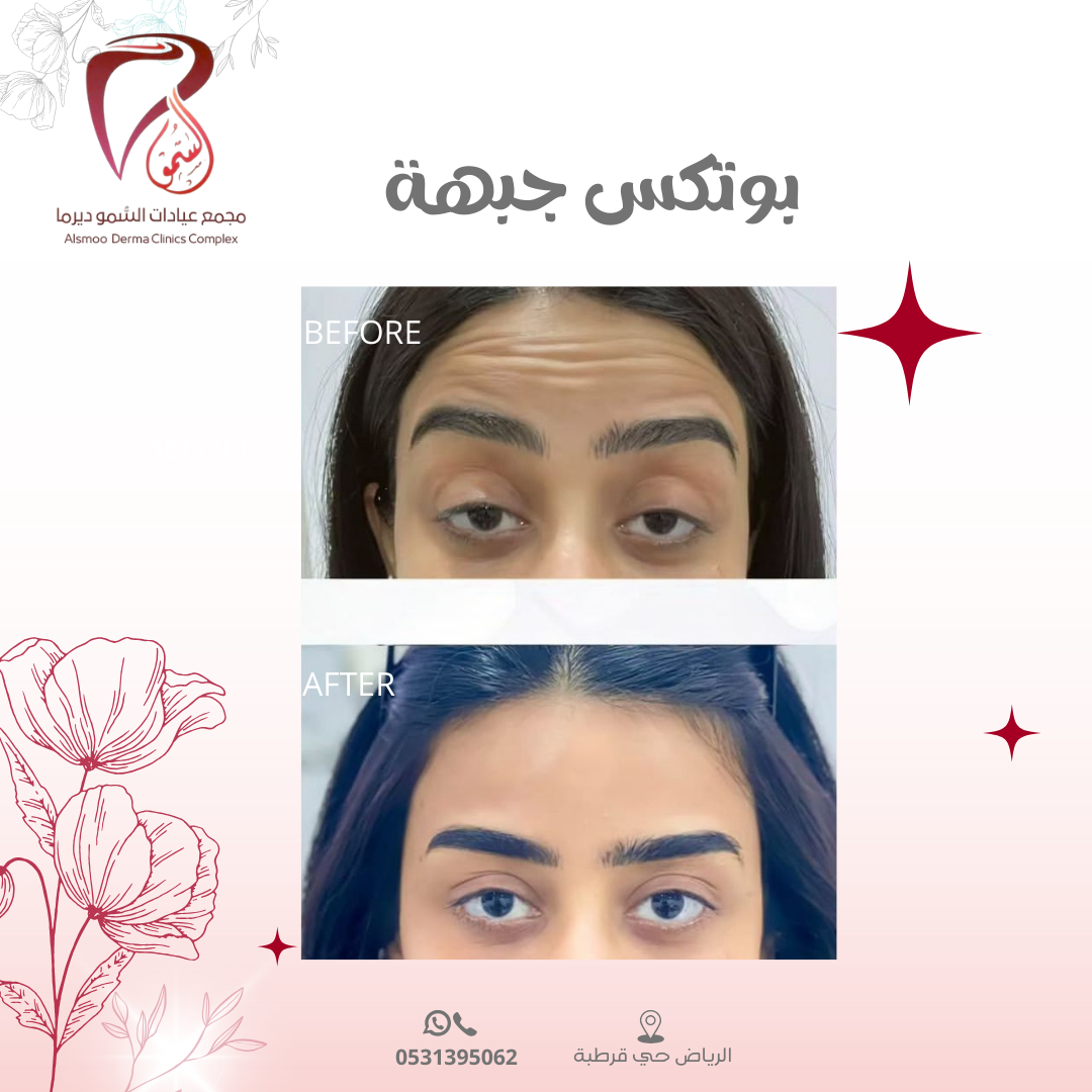 0533 22 4799 (3000 x 1000 بيكسل) (1080 x 1080 بيكسل) (15)