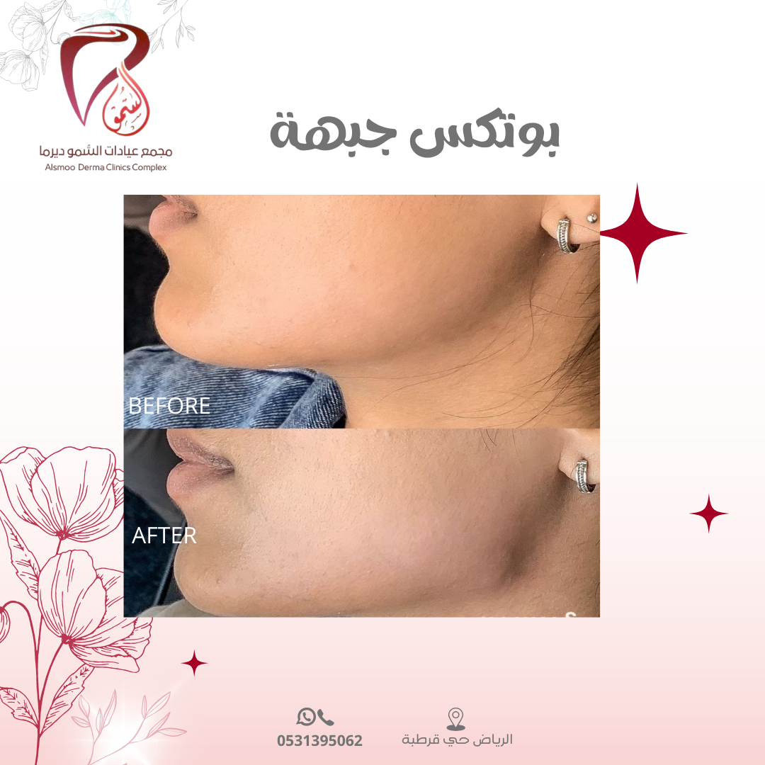 0533 22 4799 (3000 x 1000 بيكسل) (1080 x 1080 بيكسل) (16)