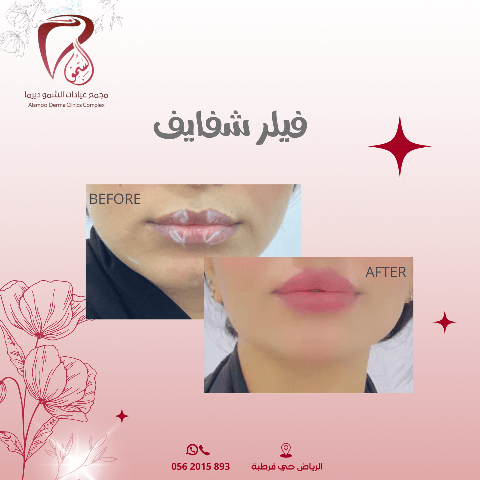 0533 22 4799 (3000 x 1000 بيكسل) (1080 x 1080 بيكسل) (21)