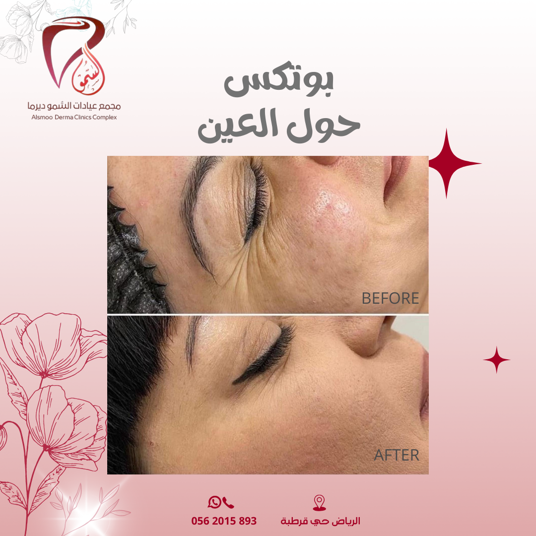 0533 22 4799 (3000 x 1000 بيكسل) (1080 x 1080 بيكسل) (22)