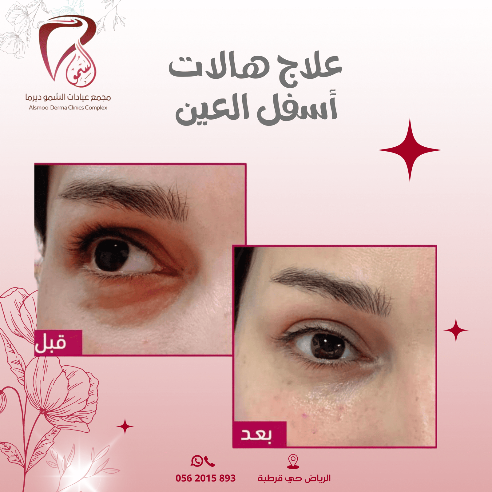 0533 22 4799 (3000 x 1000 بيكسل) (1080 x 1080 بيكسل) (23)