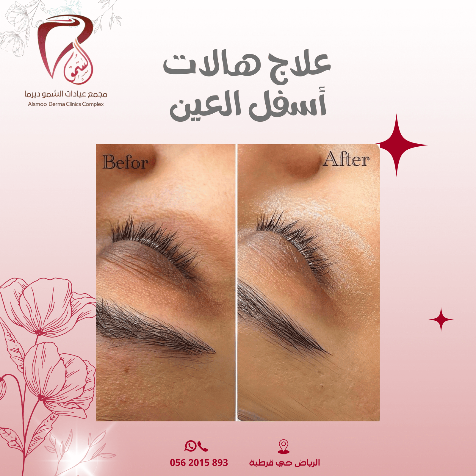 0533 22 4799 (3000 x 1000 بيكسل) (1080 x 1080 بيكسل) (24)