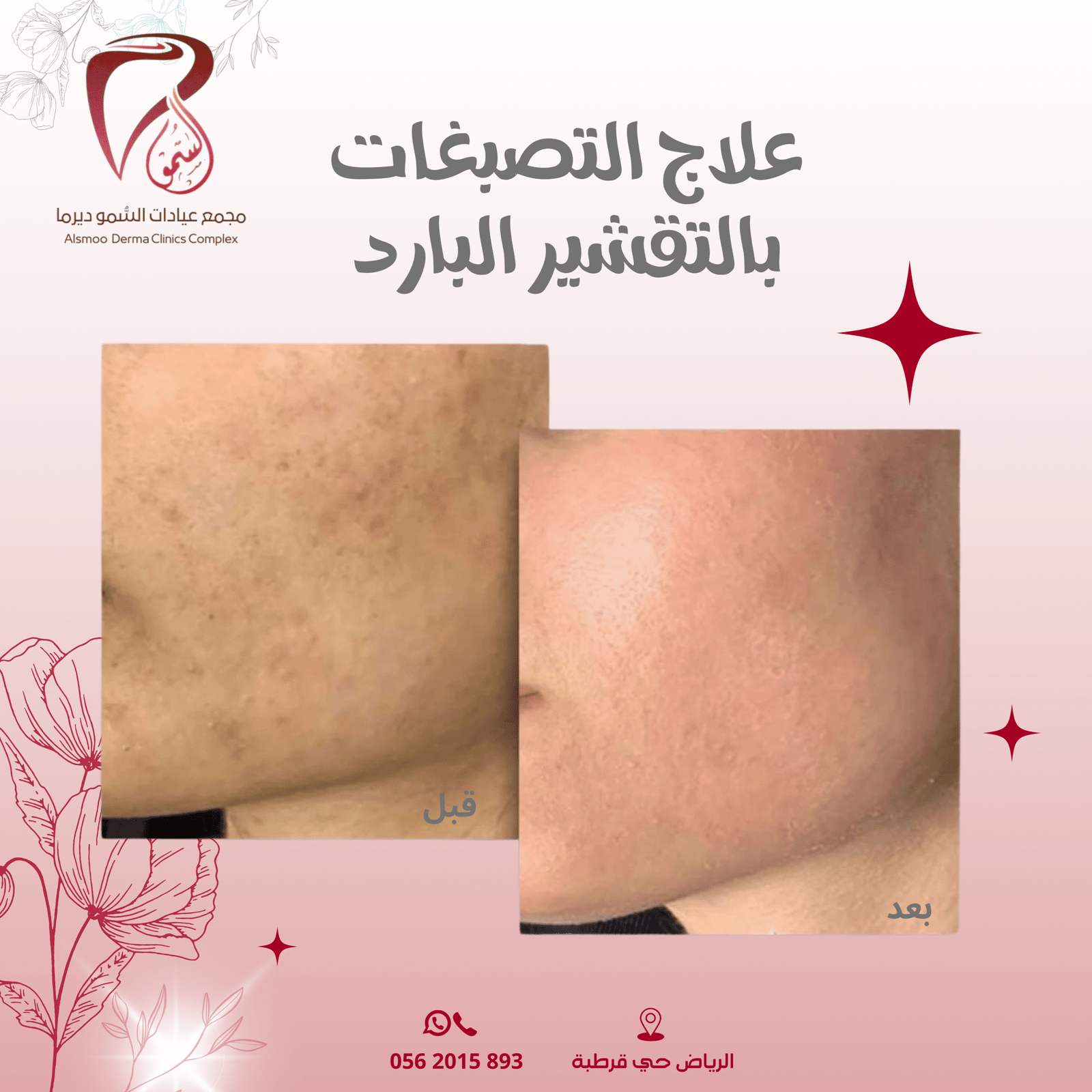 0533 22 4799 (3000 x 1000 بيكسل) (1080 x 1080 بيكسل) (26)