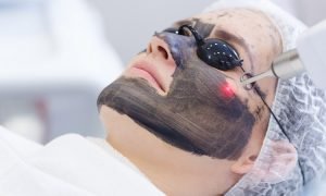 Laser-Carbon-Peel-Treatment-in-Riyadh-Saudi-Arabia-Cost